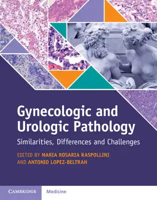 Gynecologic and Urologic Pathology: Similarities, Differences and Challenges [With eBook]