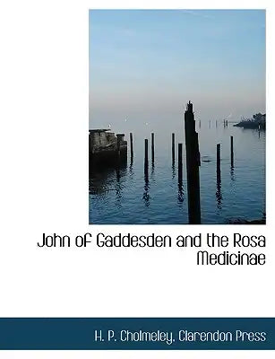 John of Gaddesden and the Rosa Medicinae