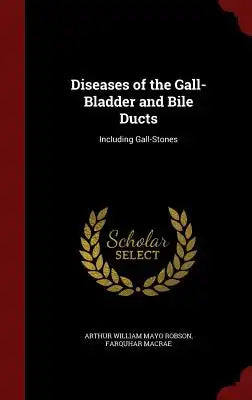Diseases of the Gall-Bladder and Bile Ducts: Including Gall-Stones