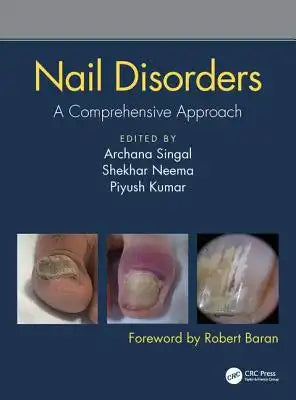Nail Disorders: A Comprehensive Approach