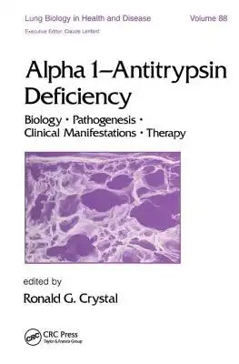 Alpha 1 - Antitrypsin Deficiency: Biology-Pathogenesis-Clinical Manifestations-Therapy