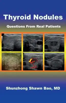 Thyroid Nodules: Questions From Real Patients