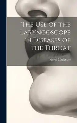 The Use of the Laryngoscope in Diseases of the Throat