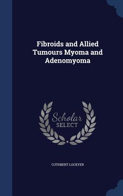 Fibroids and Allied Tumours Myoma and Adenomyoma