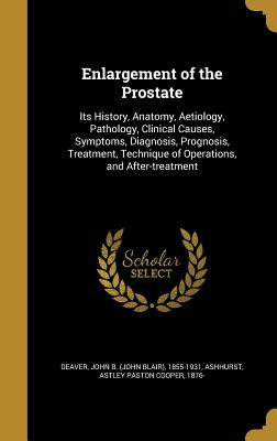 Enlargement of the Prostate: Its History, Anatomy, Aetiology, Pathology, Clinical Causes, Symptoms, Diagnosis, Prognosis, Treatment, Technique of O