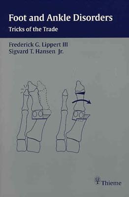 Foot and Ankle Disorders: Tricks of the Trade