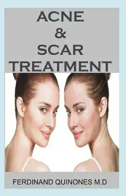 Acne & Scar Treatment: All You Need to about Curing Acne with Ease, Quickly and Naturally.
