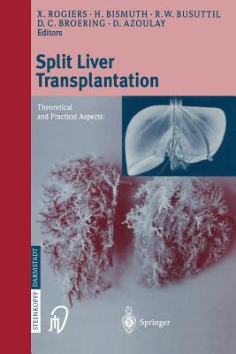 Split Liver Transplantation: Theoretical and Practical Aspects
