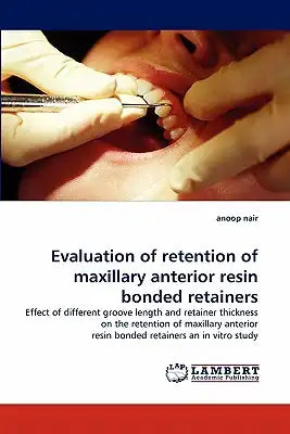 Evaluation of Retention of Maxillary Anterior Resin Bonded Retainers