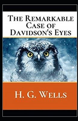 The Remarkable Case of Davidson's Eyes Illustrated